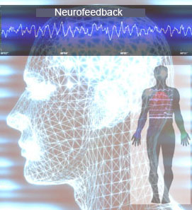 Neurofeedback1